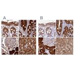 PBLD Antibody in Immunohistochemistry (IHC)