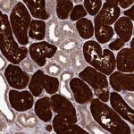 PBLD Antibody in Immunohistochemistry (IHC)