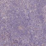 PBLD Antibody in Immunohistochemistry (IHC)