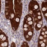 PBLD Antibody in Immunohistochemistry (IHC)