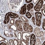 PTER Antibody in Immunohistochemistry (IHC)