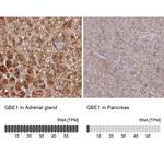 GBE1 Antibody