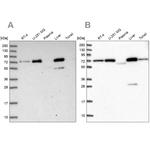 GBE1 Antibody in Western Blot (WB)