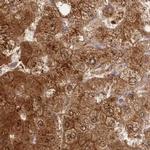 GBE1 Antibody in Immunohistochemistry (IHC)