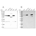 GBE1 Antibody in Western Blot (WB)