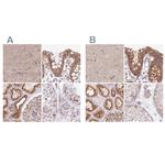 HIP1R Antibody in Immunohistochemistry (IHC)