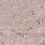 HIP1R Antibody in Immunohistochemistry (IHC)