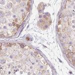 HIP1R Antibody in Immunohistochemistry (IHC)