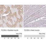 PLCD4 Antibody in Immunohistochemistry (IHC)