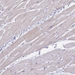 PLCD4 Antibody in Immunohistochemistry (IHC)