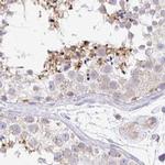 PLCD4 Antibody in Immunohistochemistry (IHC)