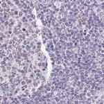 PLCD4 Antibody in Immunohistochemistry (IHC)