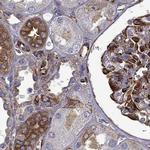 MAP4 Antibody in Immunohistochemistry (IHC)