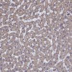 MAP4 Antibody in Immunohistochemistry (IHC)