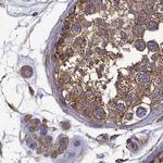 MAP4 Antibody in Immunohistochemistry (IHC)