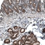 TBC1D23 Antibody in Immunohistochemistry (IHC)