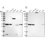 VPS37B Antibody in Western Blot (WB)