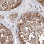 VPS37B Antibody in Immunohistochemistry (IHC)