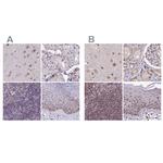 TCOF1 Antibody in Immunohistochemistry (IHC)