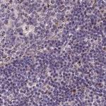 TCOF1 Antibody in Immunohistochemistry (IHC)