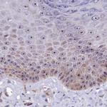 TCOF1 Antibody in Immunohistochemistry (IHC)