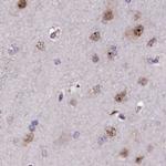 TCOF1 Antibody in Immunohistochemistry (IHC)