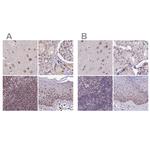 TCOF1 Antibody in Immunohistochemistry (IHC)