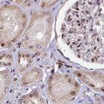 TCOF1 Antibody in Immunohistochemistry (IHC)