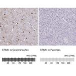 ERMN Antibody in Immunohistochemistry (IHC)