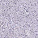 ERMN Antibody in Immunohistochemistry (IHC)