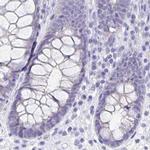 ERMN Antibody in Immunohistochemistry (IHC)