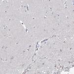 ECHDC3 Antibody in Immunohistochemistry (IHC)