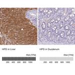 HPD Antibody in Immunohistochemistry (IHC)