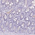 HPD Antibody in Immunohistochemistry (IHC)