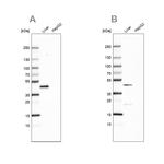 HPD Antibody in Western Blot (WB)