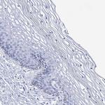 SLC3A1 Antibody in Immunohistochemistry (IHC)