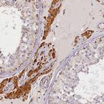 SUPV3L1 Antibody in Immunohistochemistry (IHC)