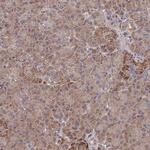 SUPV3L1 Antibody in Immunohistochemistry (IHC)