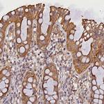 SUPV3L1 Antibody in Immunohistochemistry (IHC)