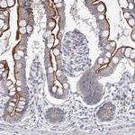 GRF-1 Antibody in Immunohistochemistry (IHC)