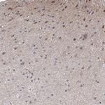 GRF-1 Antibody in Immunohistochemistry (IHC)