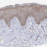 GRF-1 Antibody in Immunohistochemistry (IHC)