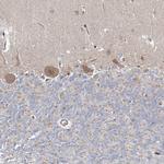 GRF-1 Antibody in Immunohistochemistry (IHC)