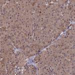 SUPV3L1 Antibody in Immunohistochemistry (IHC)