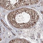 WDR48 Antibody in Immunohistochemistry (IHC)