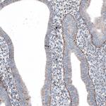 ME3 Antibody in Immunohistochemistry (IHC)