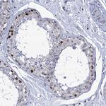 MCMBP Antibody in Immunohistochemistry (IHC)