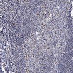 MCMBP Antibody in Immunohistochemistry (IHC)