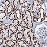 MRPS35 Antibody in Immunohistochemistry (IHC)