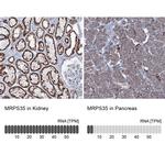 MRPS35 Antibody